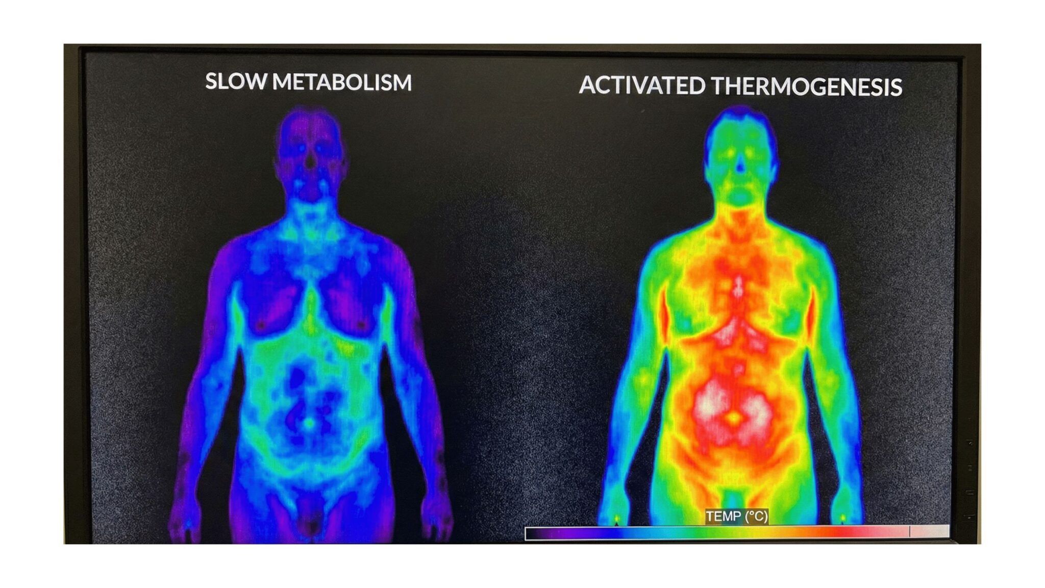 Thermogenesis Process